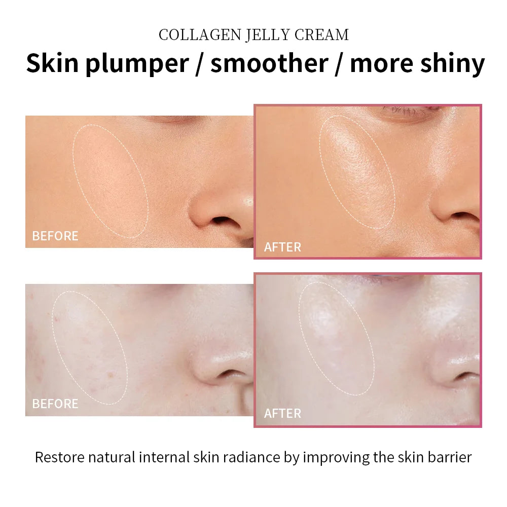 Collagen Jelly Cream – Deep Moisture, Firm, and Radiant Skin